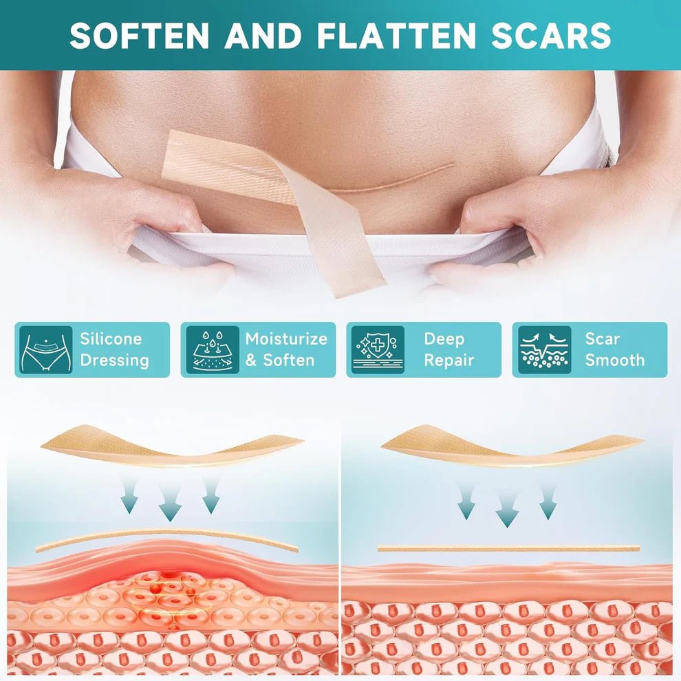 Silicone Scar Tape | Medical Grade Quality