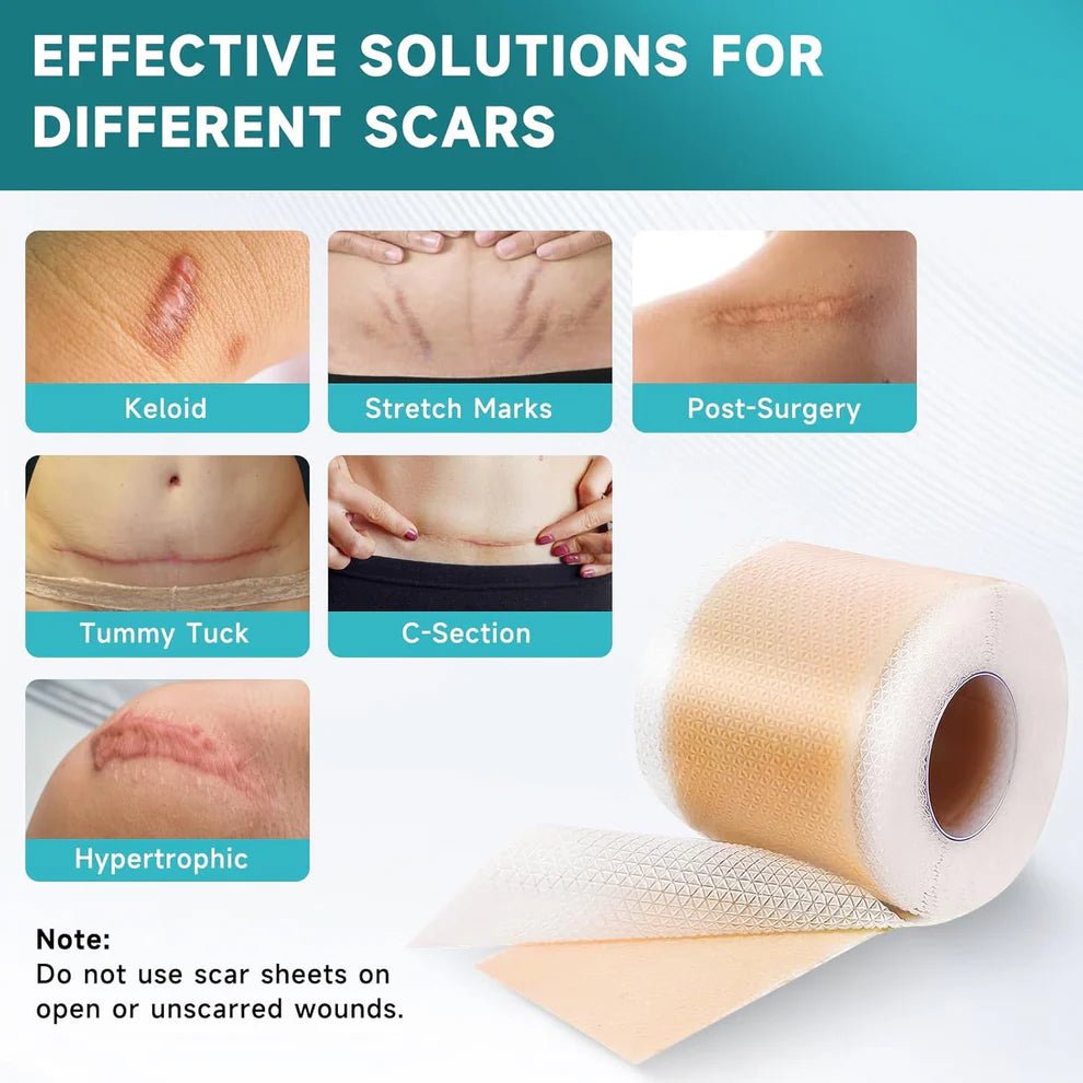 Silicone Scar Tape | Medical Grade Quality